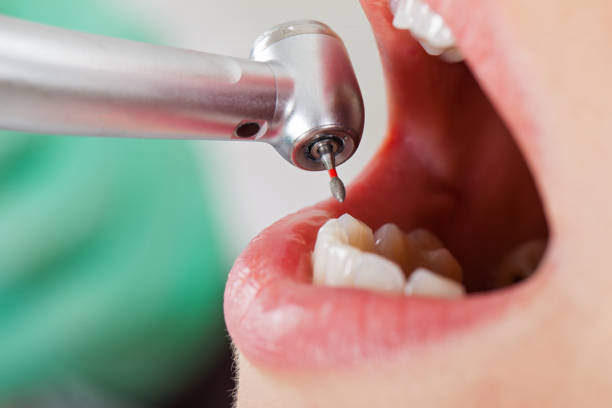Best Walk-In Emergency Dentist in Park Center, CO